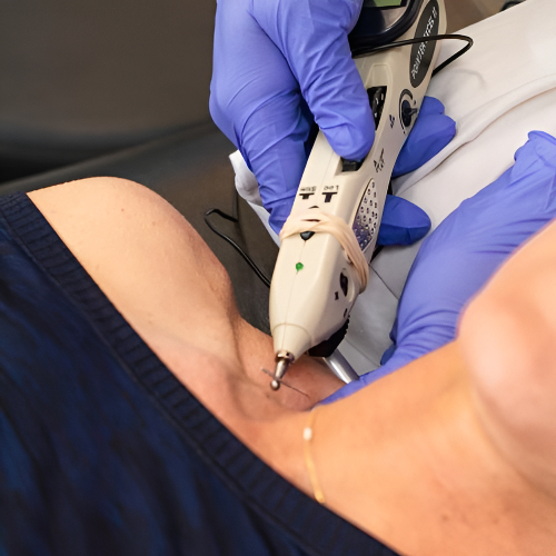 10_electrical-stimulation-Physical-Therapy-By-Phoenix-Wichita-Hutchinson-KS