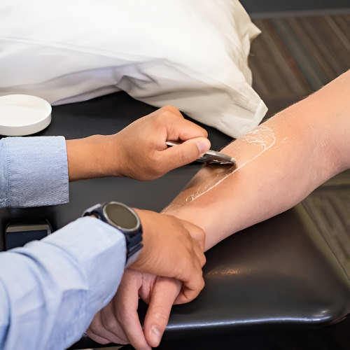 18_IASTM-Physical-Therapy-By-Phoenix-Wichita-Hutchinson-KS